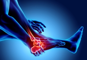 Rheumatoid Arthritis and the Feet